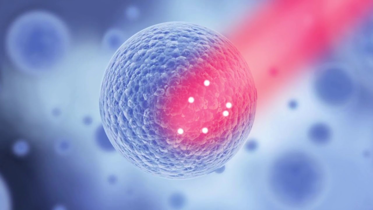 Photo Biomodulation Laser Therapy
